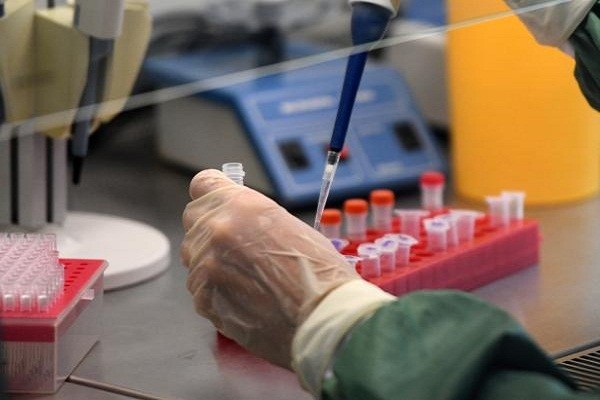Еще 22 новых случая заражения коронавирусной инфекцией зарегистрированы в Нижегородской области 